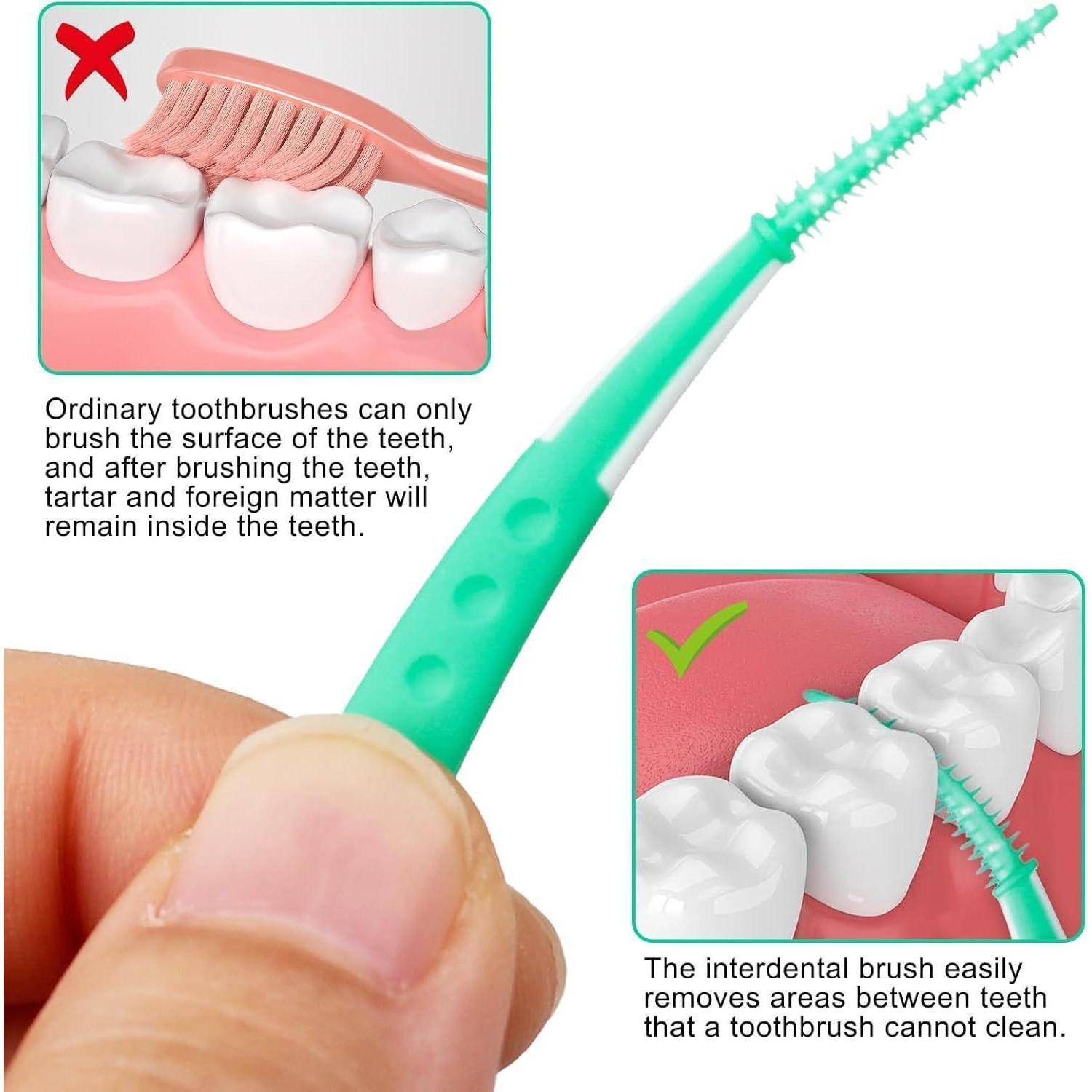 Reinigung der Zahnzwischenräume mit einer Interdentalbürste'. Oberes Bild: Zahnbürste verfehlt Zahnzwischenräume. Unteres Bild: Interdentalbürste reinigt Zahnzwischenräume effektiv.