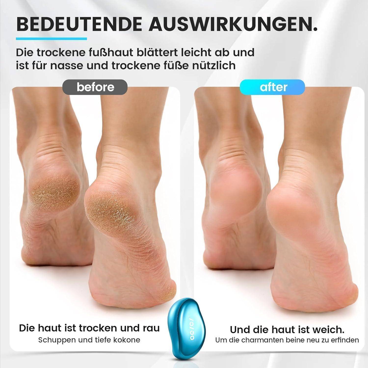 Das Bild der 'Bedeutenden Auswirkungen' zeigt einen Vorher-Nachher-Vergleich von Füßen und verdeutlicht die Verbesserung der Hautbeschaffenheit von rauh und trocken zu weich.