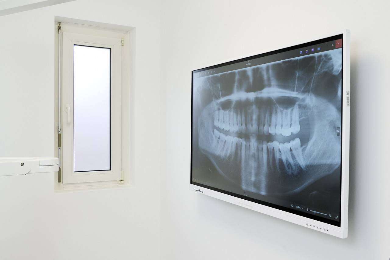 galneoscreen 55i V5 A14 (55 Zoll) das interaktive Whiteboard in elegantem Weiß inkl. Wandhalterung