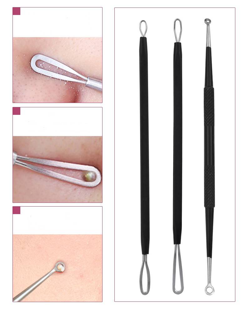 5er-Pack Mitesser-Entferner-Akne-Nadel-Werkzeugset Black