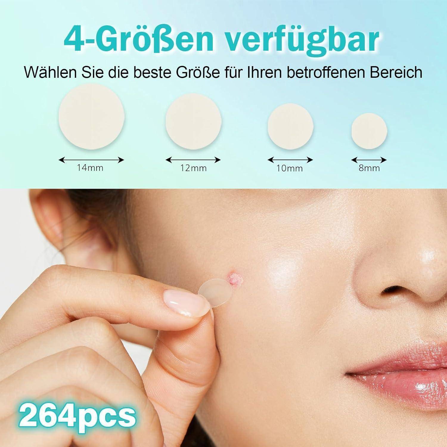 Werbebild zeigt vier verfügbare Größen von runden Hautflicken, beschriftet mit 14mm, 12mm, 10mm und 8mm, mit einer Frau, die einen auf einen Hautmakel im Gesicht aufträgt; Text besagt „4-Größen verfügbar