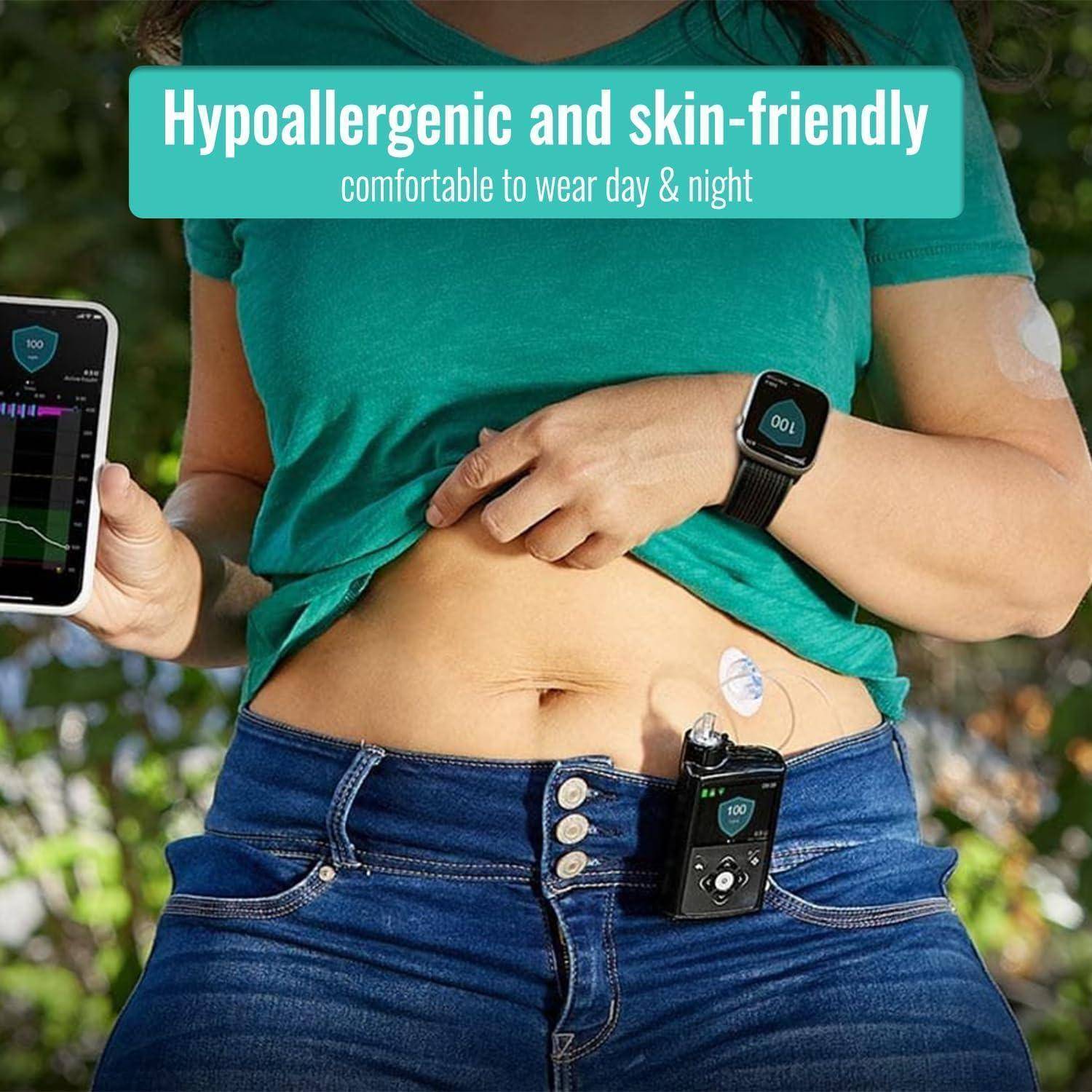 Person trägt einen medizinischen Glukosemonitor am Bauch und eine Smartwatch, hält ein Telefon in der Hand, mit Text „Hypoallergen und hautfreundlich, bequem zu tragen Tag und Nacht".