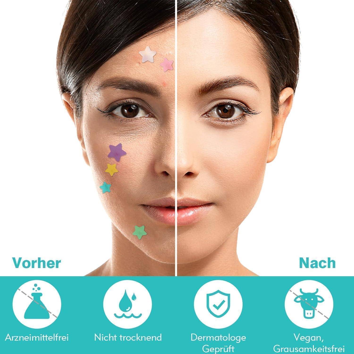 Geteiltes Vorher-Nachher-Porträt eines Hautbehandlung einer Frau, mit der Vorher-Seite zeigt Makel und Sterne, Nachher-Seite zeigt klarere Haut; Beschriftungen: Vorher, Nachher