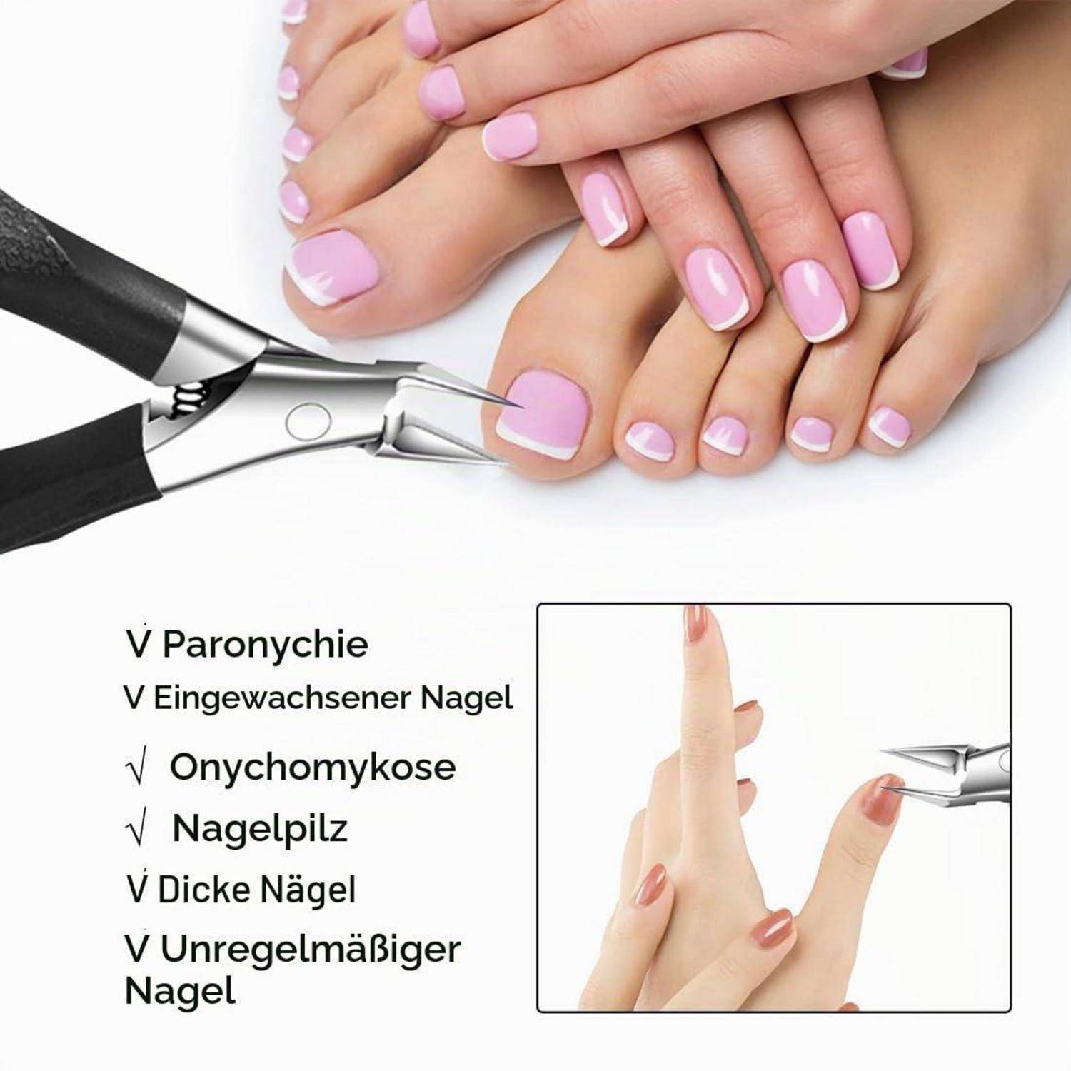 Nagelknipser in der Nähe von lackierten Zehen; Deutscher Text listet Nagelprobleme auf: Paronychie, eingewachsener Nagel, Onychomykose, verdickte und unregelmäßige Nägel.