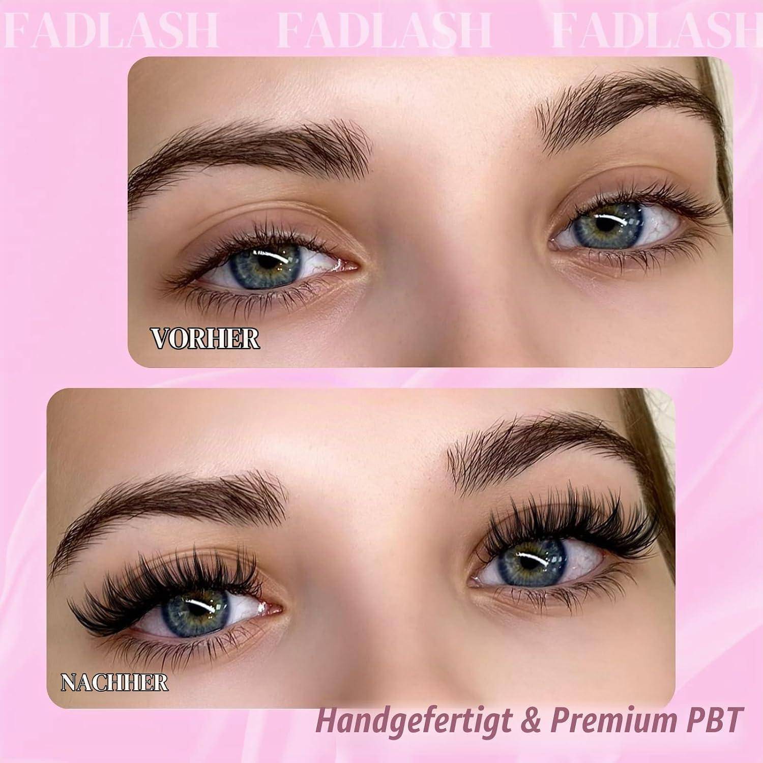 Vor-und-Nachher-Nahaufnahme von blauen Augen, die im „NACHHER
