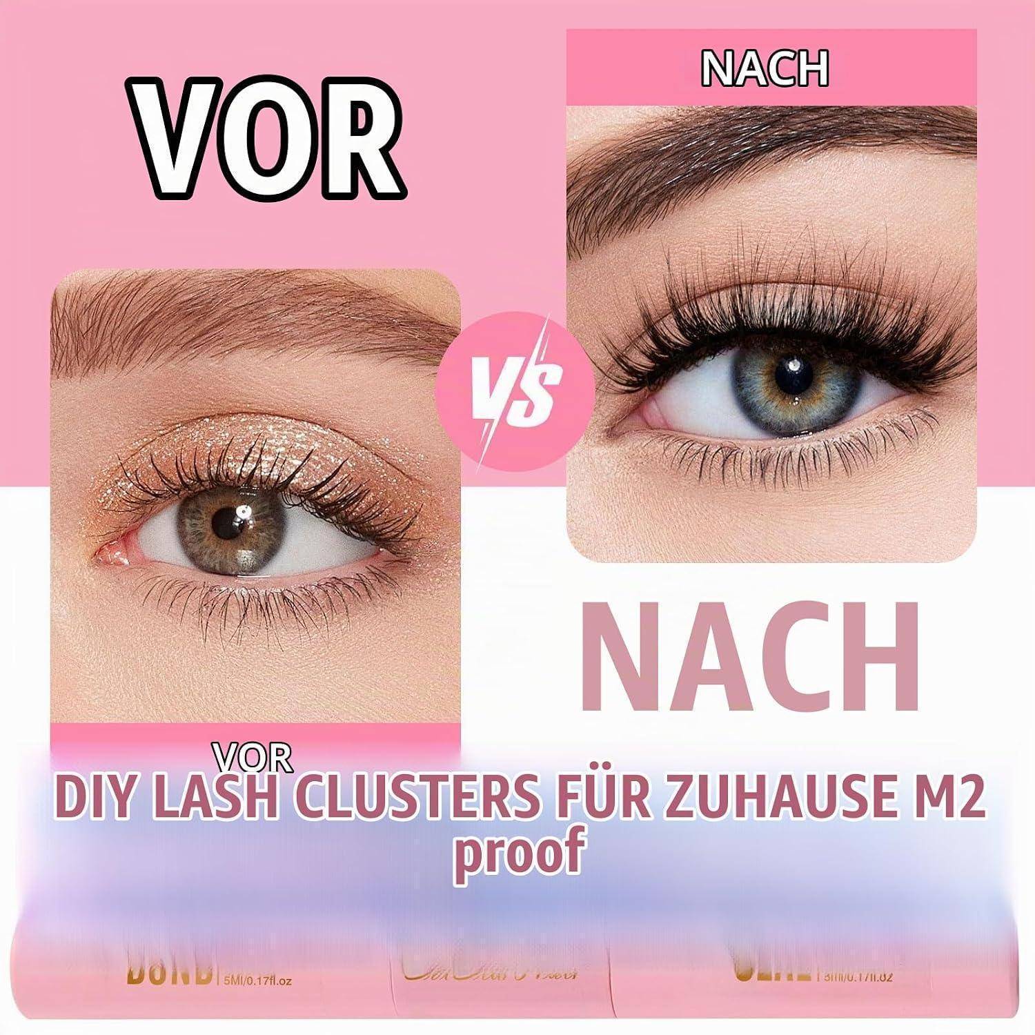 Vorher-und-Nachher-Vergleich eines Auges mit Wimpernbündeln: Links mit der Bezeichnung „VOR