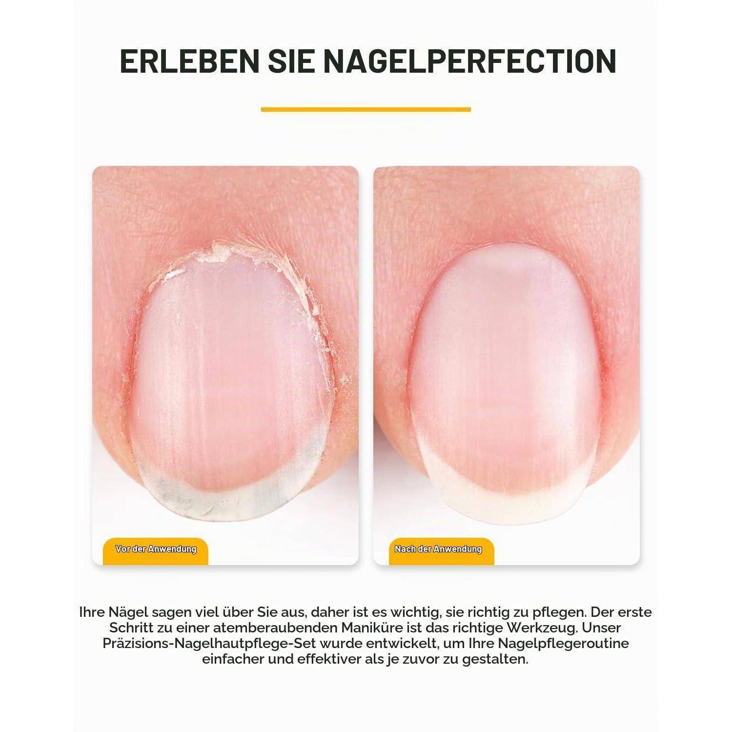 BEZOX Nagelhautzange mit Nagelhautschieber Set - Präzises Nagelhaut Knipser und Unter-Nagel-Reinigungsset für den Salon- oder Heimgebrauch - Chirurg