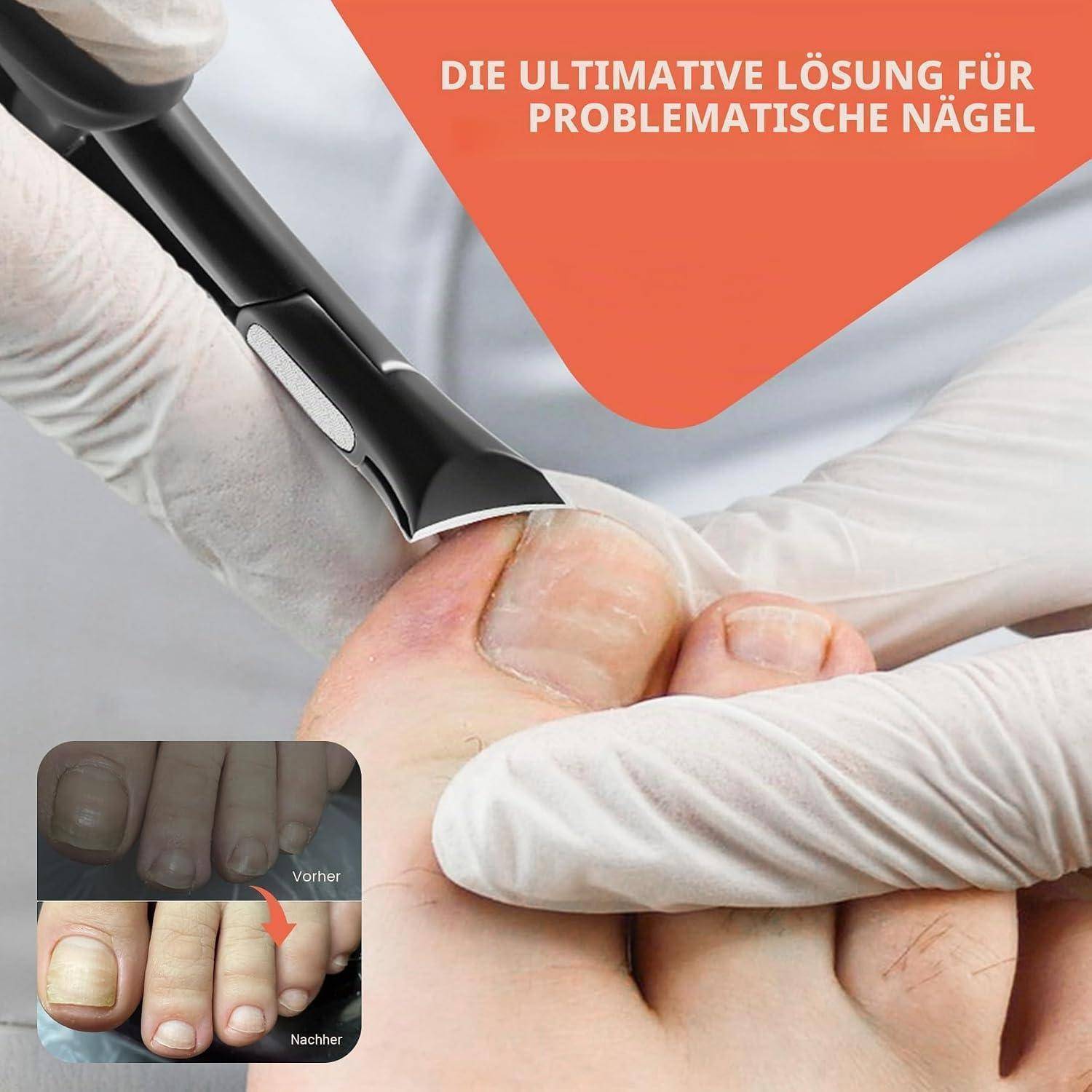 BEZOX Präzisions-Nagelzange für dicke Nägel, schwarz
