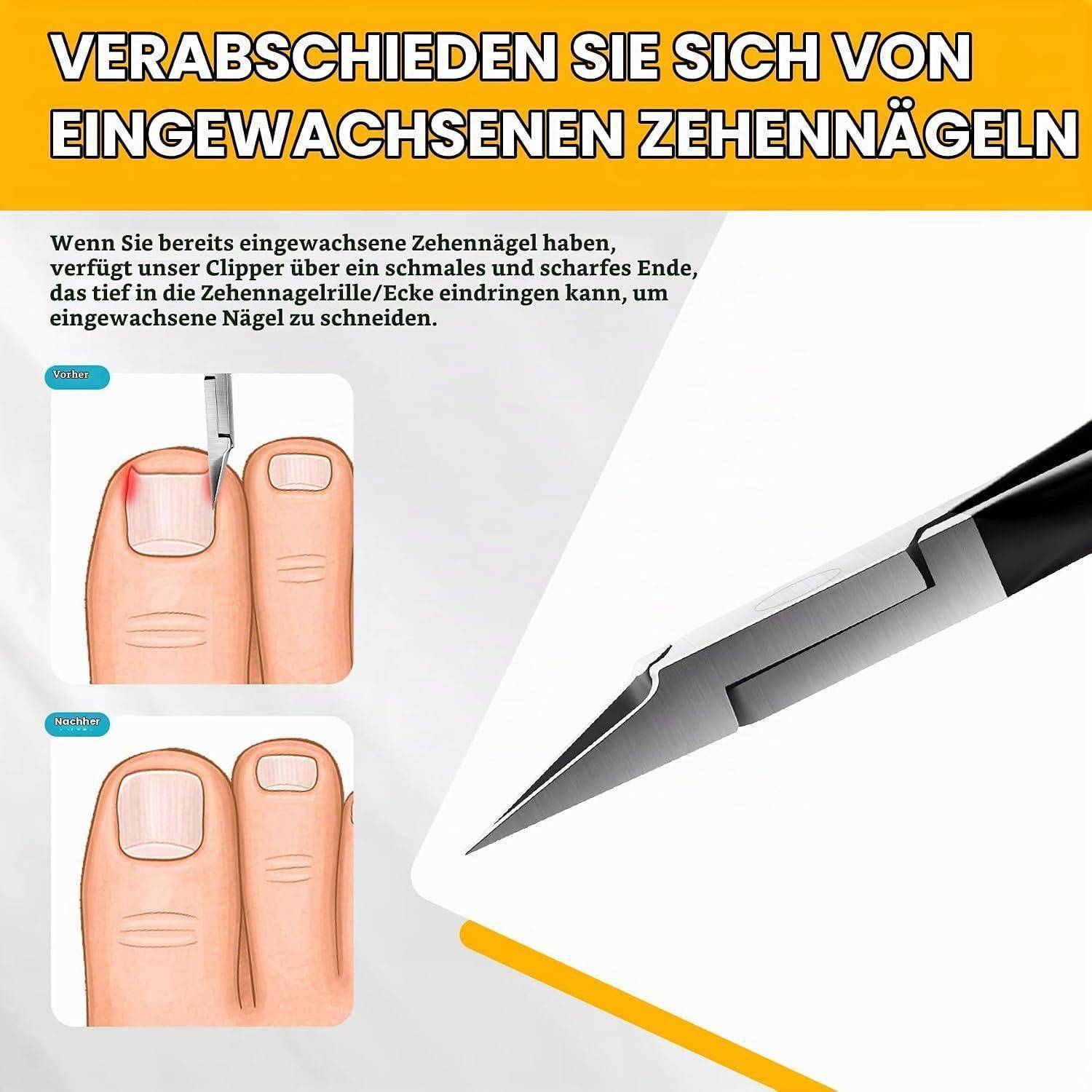 BEZOX Nagelknipser für dicke Zehennägel gerade Klinge Schwarz