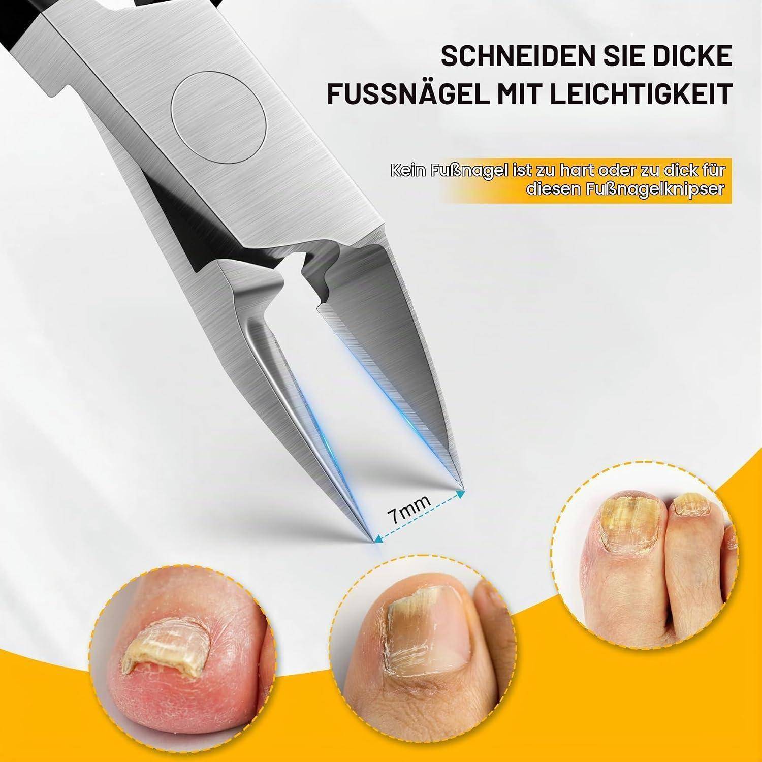Werbebild einer Nagelschere, die dicke Fußnägel mühelos schneidet, mit deutschem Text und detaillierten Vorher-Nachher-Beispielen der Nägel, die eine Schnittbreite von 7 mm zeigen.