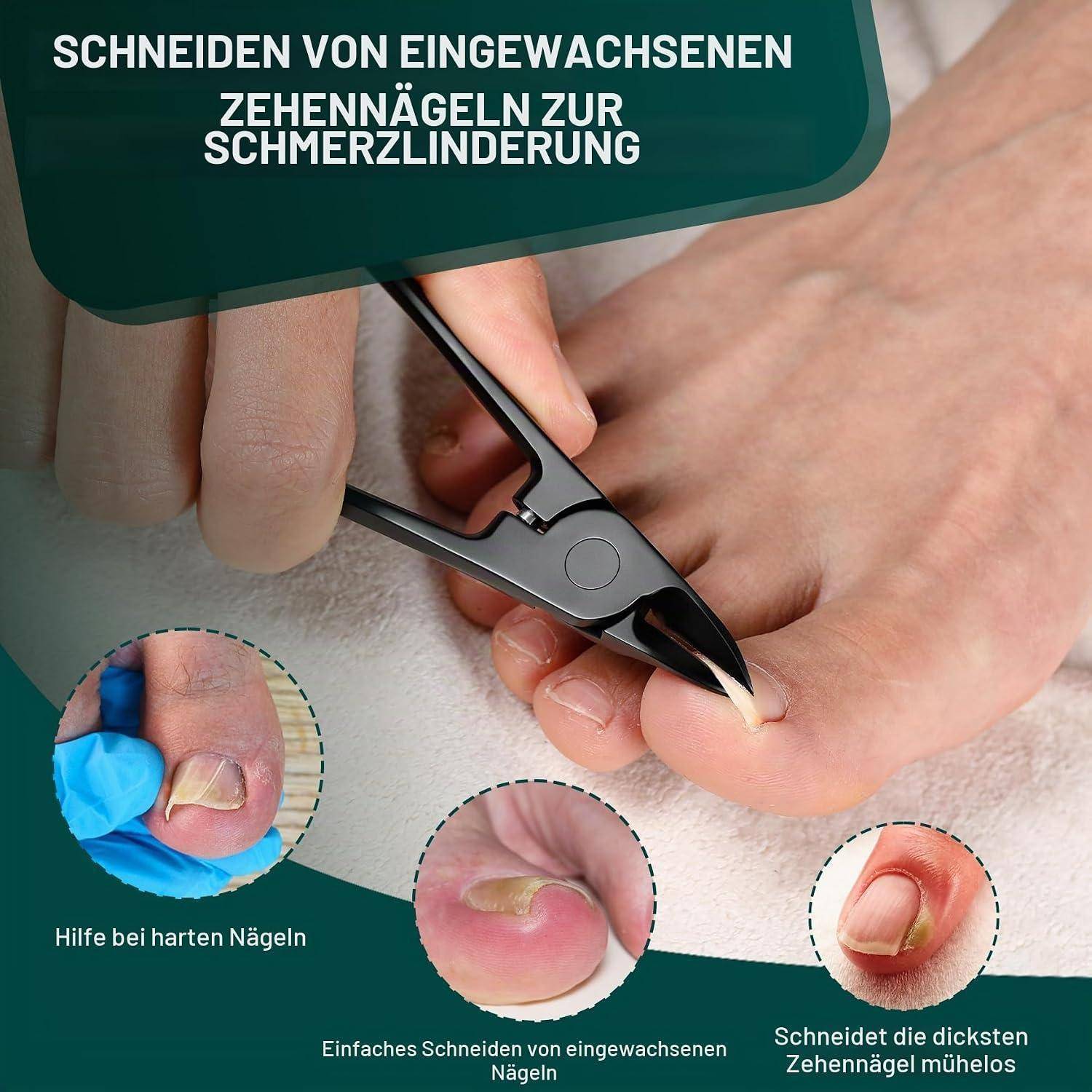 FVION Nagelzange Fußnägel Edelstahl Schwarz für dicke Nägel