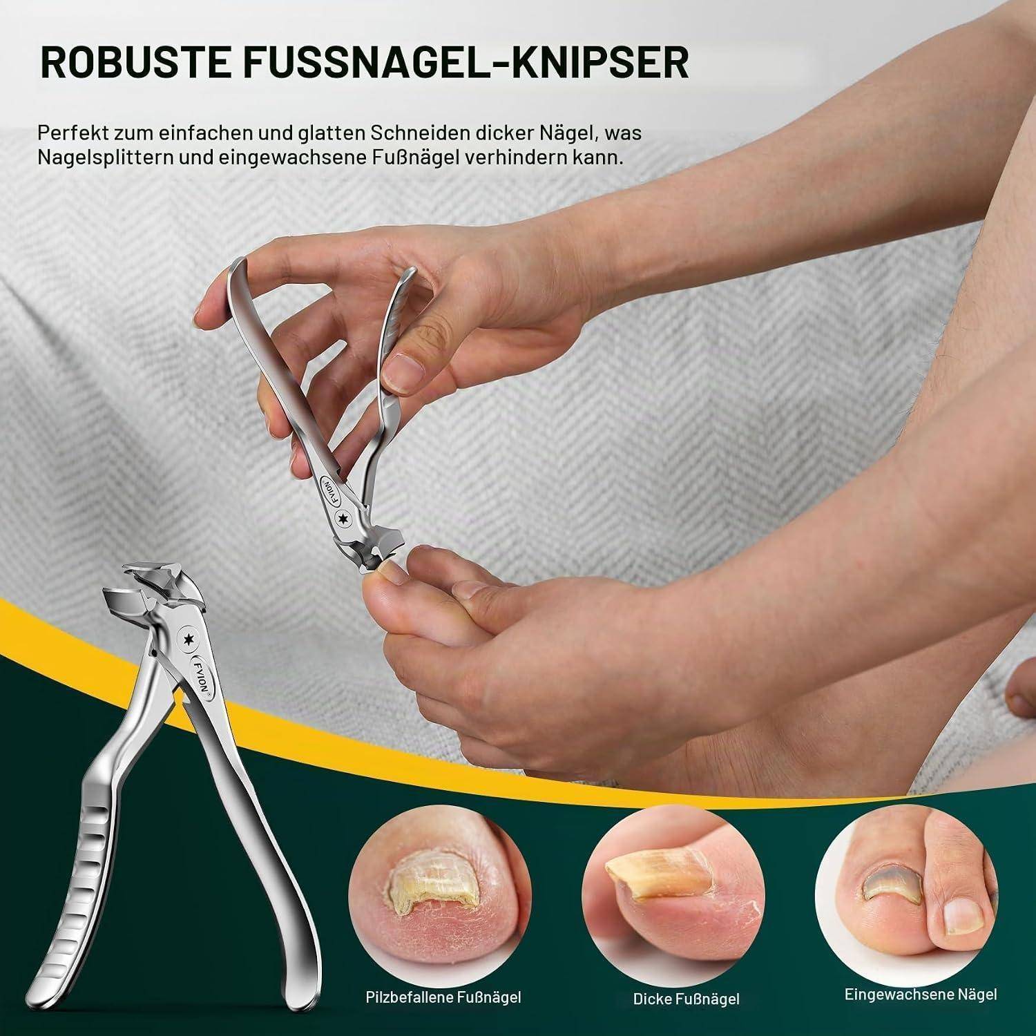 FVION Nagelknipser Fußnägel mit langem Griff und Auffangbehälter