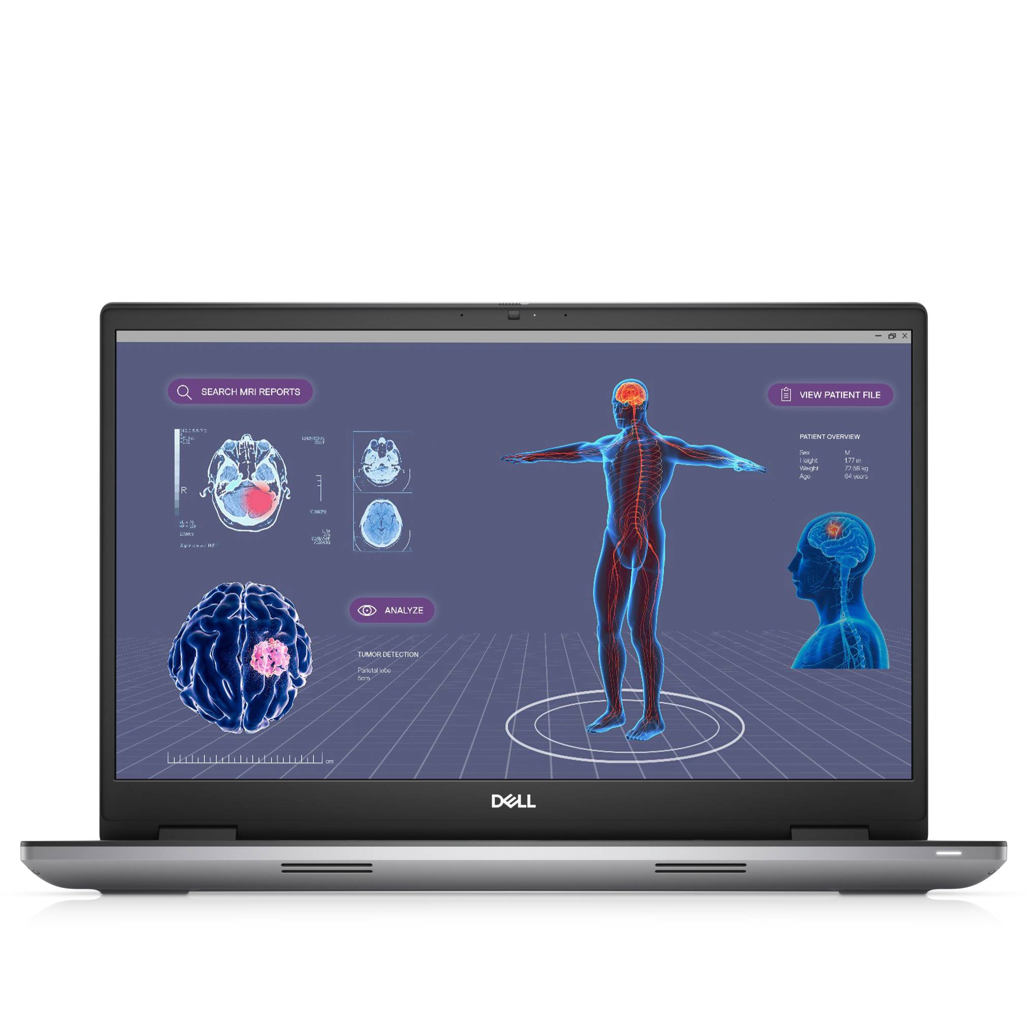 Dell-Laptop zeigt eine medizinische KI-Schnittstelle mit Gehirnscans, einer ganzkörperhaften menschlichen Figur und Patientenanalysereglern.