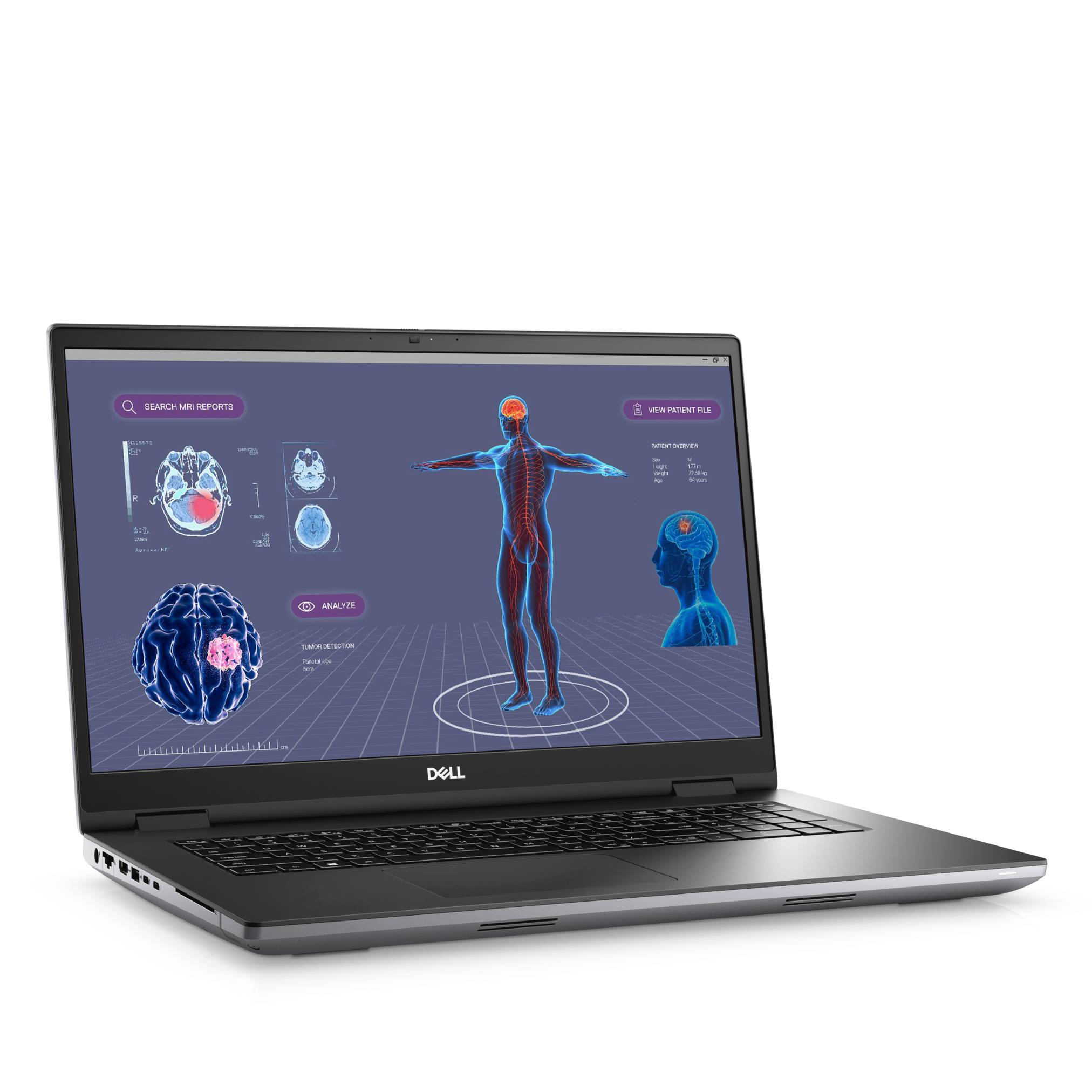 Dell Laptop zeigt eine medizinische Schnittstelle mit Gehirnscans, einem menschlichen Körperdiagramm und neurologischen Daten auf dem Bildschirm an.