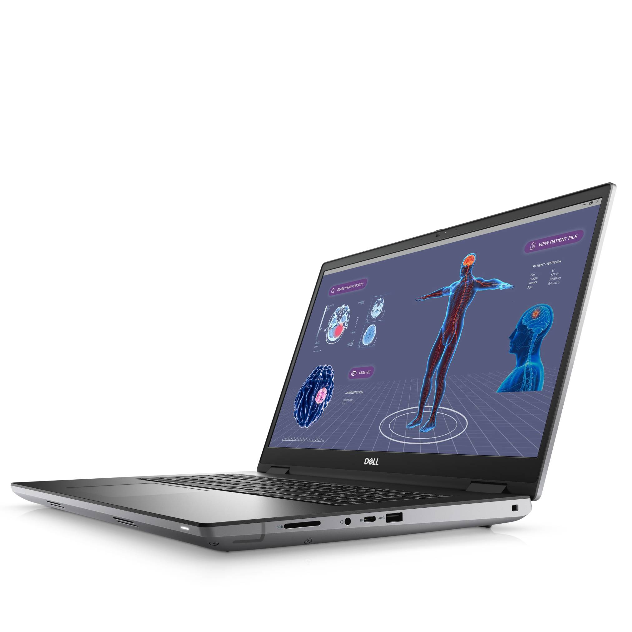 Silver-Dell-Laptop mit einer medizinischen 3D-Benutzeroberfläche des menschlichen Körpers mit Gehirn- und Kopfscans auf einem dunklen Bildschirm.