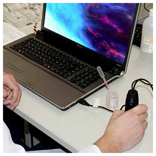 Hands at a laptop on a desk, with a pipette and small sample container beside it, suggesting a lab or testing setup.