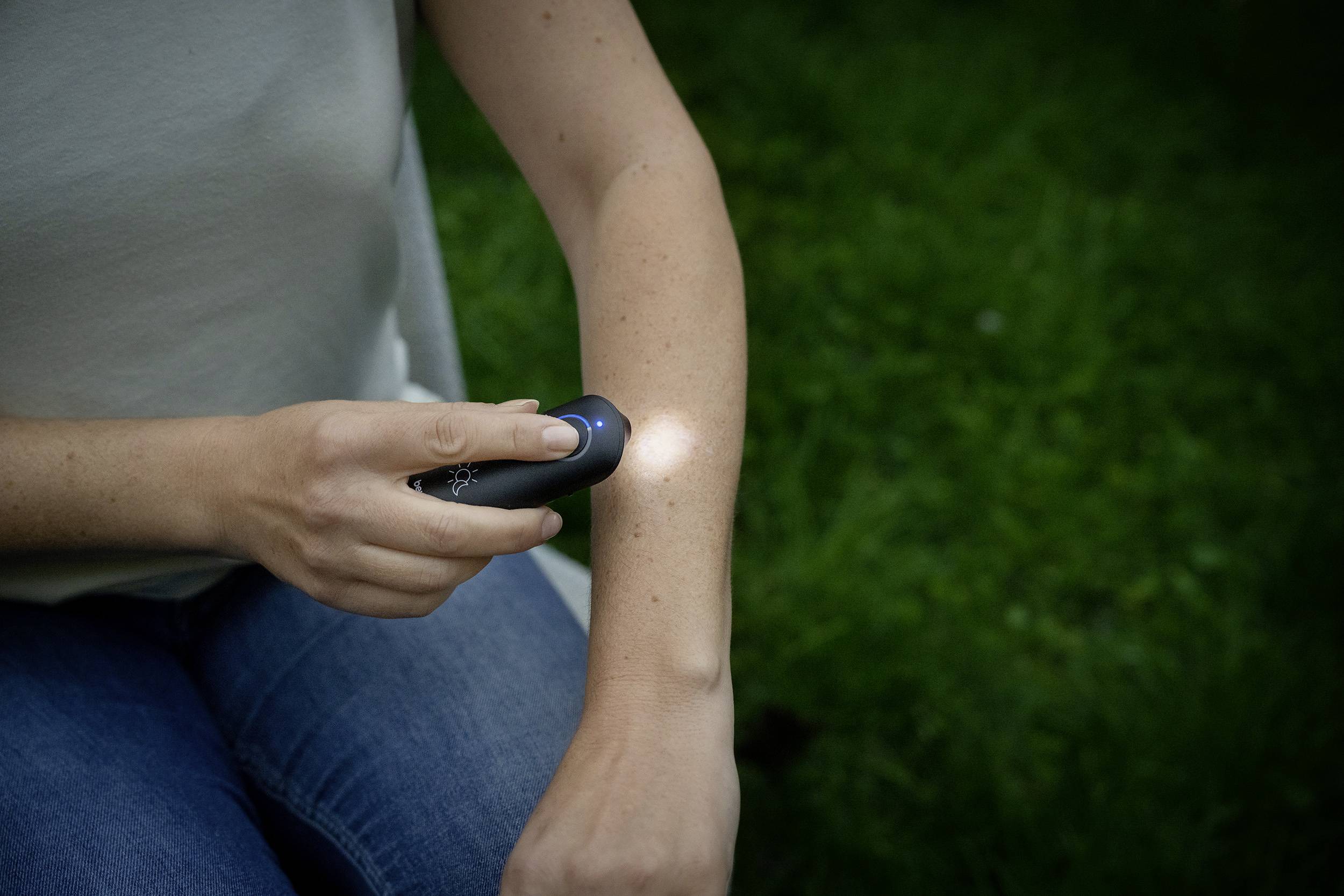 Beurer BR 90 Insect bite treatment