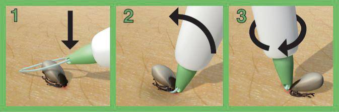 3iX tick sling Tick lasso remover White 1 pc(s)