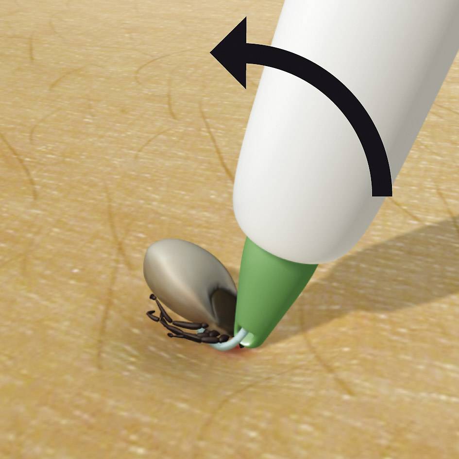 3iX tick sling Boucle enlève-tique blanc 1 pc(s)