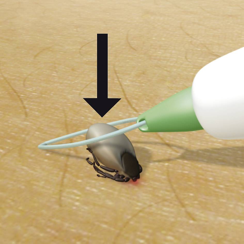 3iX tick sling Boucle enlève-tique blanc 1 pc(s)