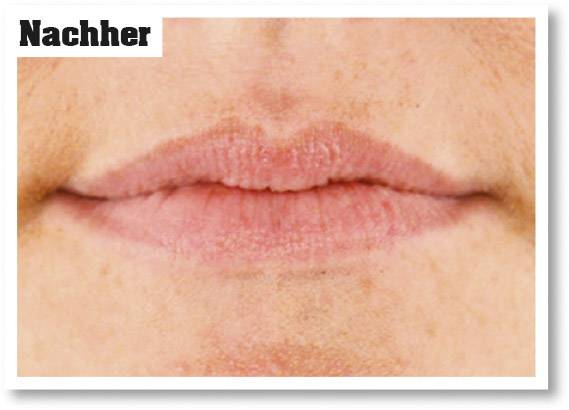 O'Keeffe's Lip Repair Baume à lèvres